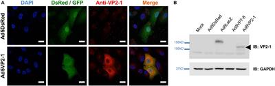 Vaccination With Recombinant Adenoviruses Expressing the Bluetongue Virus Subunits VP7 and VP2 Provides Protection Against Heterologous Virus Challenge